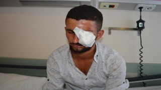 YERDE BULDUĞU HAVAİ FİŞEĞİN PATLAMASIYLA GÖZÜNDEN YARALANDI